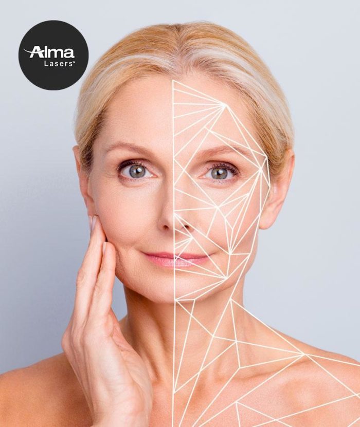 Clear Lift Skin Tightening | Skin Deep Midtown Med Spa.