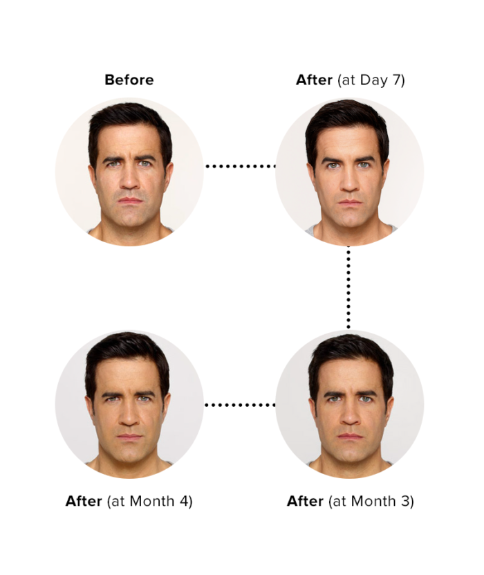 Copy of Botox Injections Per Unit | Skin Deep Midtown Med Spa.