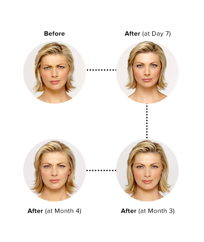Copy of Botox Injections Per Unit | Skin Deep Midtown Med Spa.