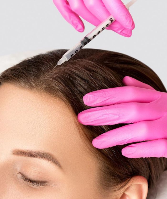 PRP Scalp Injections | Skin Deep Midtown Med Spa.