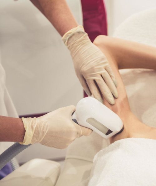 Laser Hair Removal | Skin Deep Midtown Med Spa.