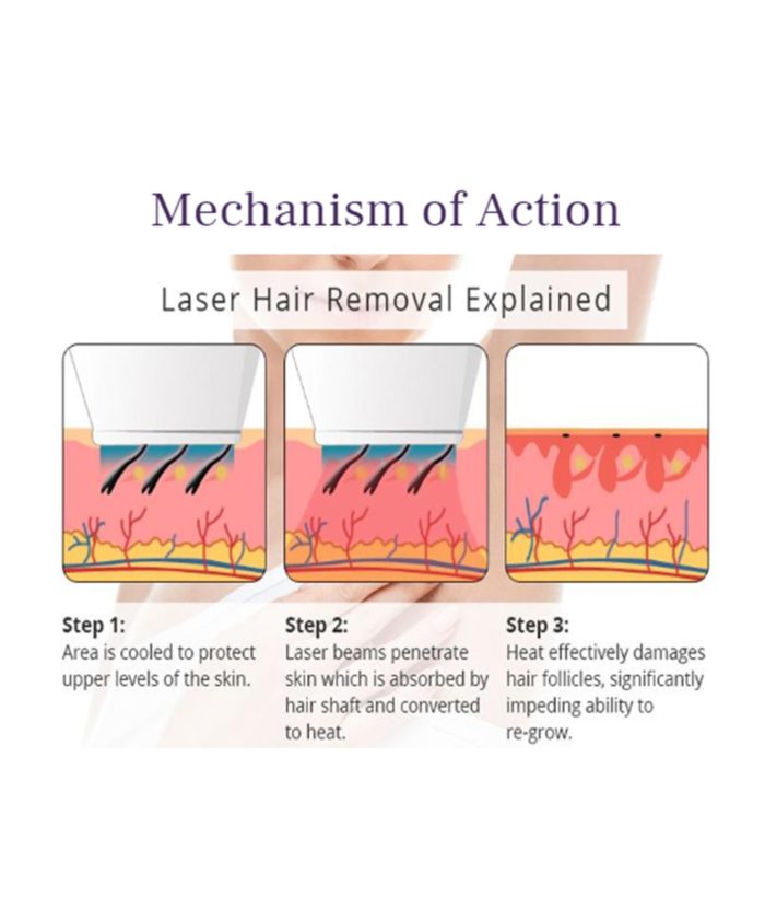 Laser Hair Removal | Skin Deep Midtown Med Spa.