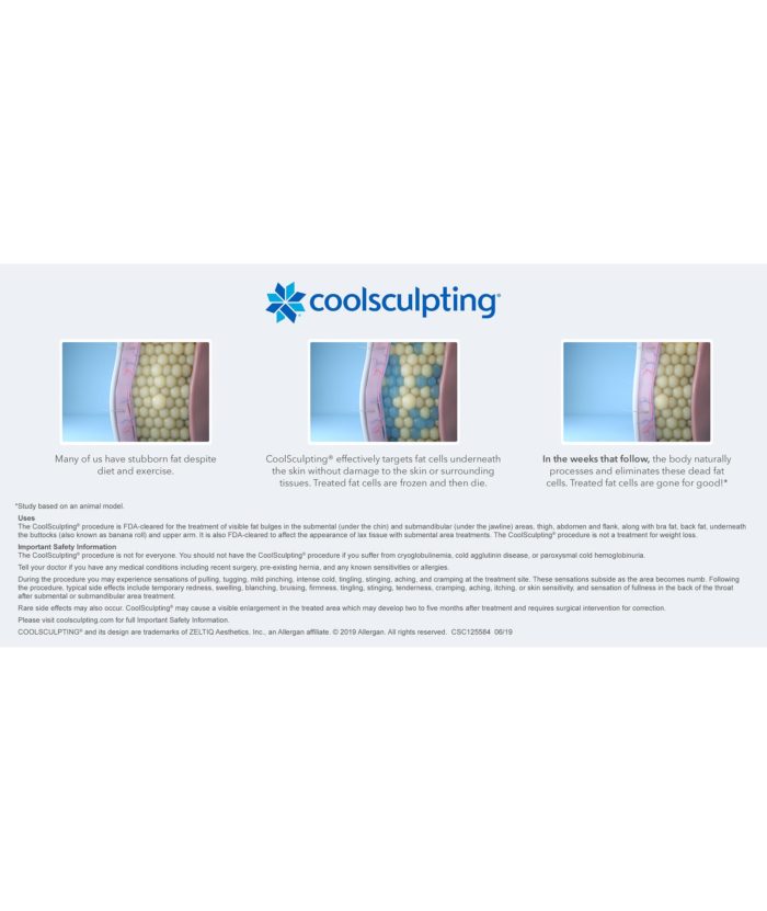 Coolsculpting – Body Contouring | Skin Deep Midtown Med Spa.