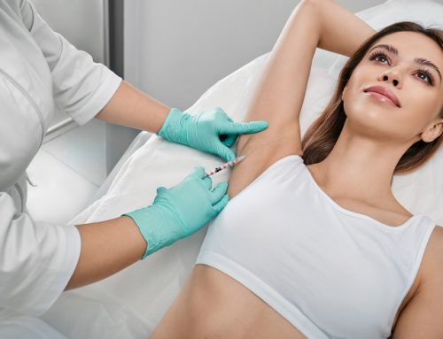 Botox for Underarm Sweating: Everything You Need To Know