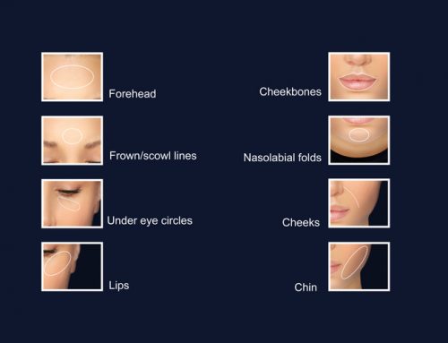 How Long Does Botox Take to Work