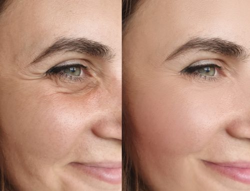 Is Botox Bad for you?