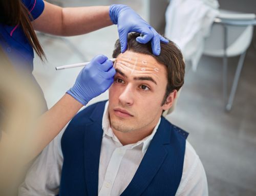 Should Men Get Botox?