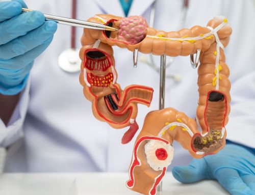 When Should You See a Colon and Rectal Specialist?